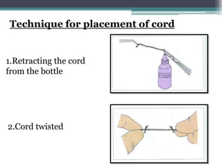 Technique for placement of cord


1.Retracting the cord
from the bottle




2.Cord twisted
 