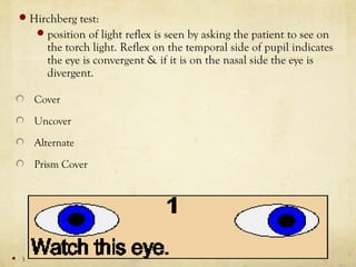 Hirschberg Examples Preliminary examination | PPT