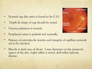 Preliminary examination | PPT