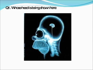 Q1. Whose head is being shown here: 