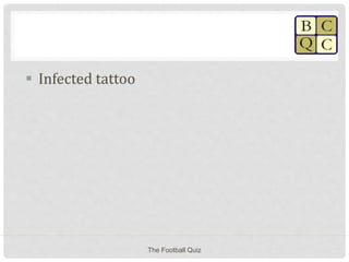  Infected tattoo
The Football Quiz
 