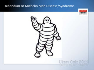 What are we talking about?Fibonacci Series