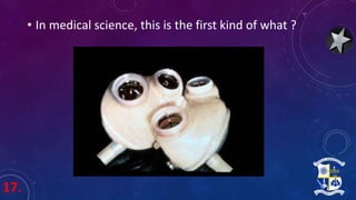 17.
• In medical science, this is the first kind of what ?
 