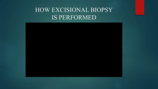 HOW EXCISIONAL BIOPSY
IS PERFORMED
 