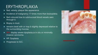 ERYTHROPLAKIA
 Red, velvety, plaque like appearance.
 Incidence of malignancy 17 times more than leukoplakia.
 Red coloured due to submucosal blood vessels seen
through it.
 Biopsy is must.
 remains level with or may b slightly depressed relative to
the surrounding mucosa.
 90% display severe dysplasia,ca in situ or minimally
invasive carcinoma.
 HP: Dysplasia.
 Progresses to SCC.
 