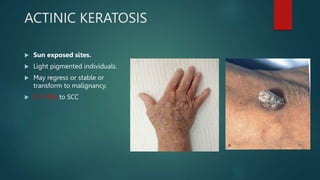 ACTINIC KERATOSIS
 Sun exposed sites.
 Light pigmented individuals.
 May regress or stable or
transform to malignancy.
 0.1-10% to SCC
 