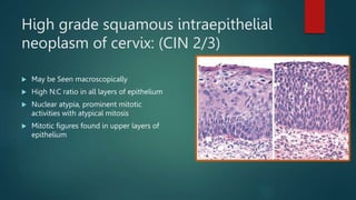 High grade squamous intraepithelial
neoplasm of cervix: (CIN 2/3)
 May be Seen macroscopically
 High N:C ratio in all layers of epithelium
 Nuclear atypia, prominent mitotic
activities with atypical mitosis
 Mitotic figures found in upper layers of
epithelium
 