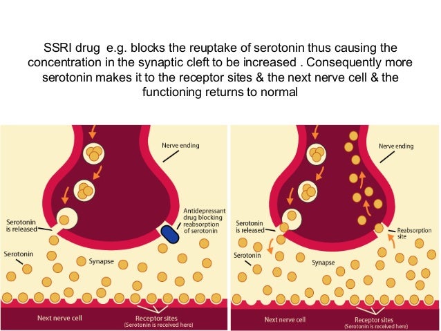 Does viagra delay ejaculation