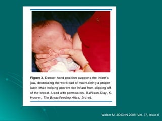 Walker M.,JOGNN 2008; Vol. 37, Issue 6
 