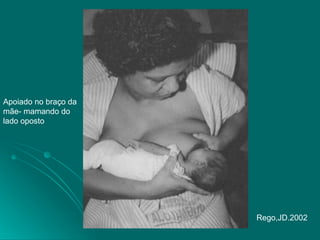 Apoiado no braço da
mãe- mamando do
lado oposto
Rego,JD.2002
 