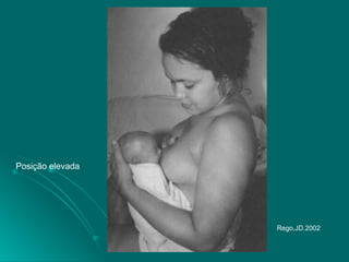 Posição elevada
Rego,JD.2002
 
