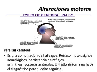 Alteraciones motoras




Parálisis cerebral
• Es una combinación de hallazgos: Retraso motor, signos
  neurológicos, persistencia de reflejos
  primitivos, posturas anómalas. UN sólo síntoma no hace
  el diagnóstico pero si debe seguirse.
 