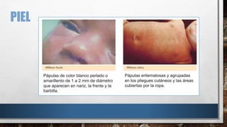 PREMATURIDAD Y EXAMEN FÍSICO, patologias congenitas. | PDF