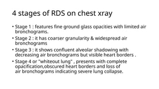 Air Bronchogram Rds prematurity obsterteric presentation.pptx
