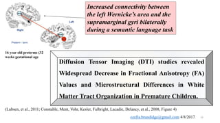 Prematurity affects the integrity of the dorsal and ventral streams | PPTX