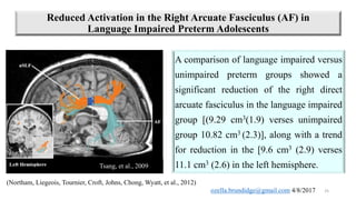 Prematurity affects the integrity of the dorsal and ventral streams | PPTX