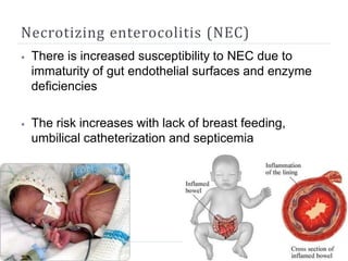 Necrotizing enterocolitis (NEC)
⦁ There is increased susceptibility to NEC due to
immaturity of gut endothelial surfaces and enzyme
deficiencies
⦁ The risk increases with lack of breast feeding,
umbilical catheterization and septicemia
 