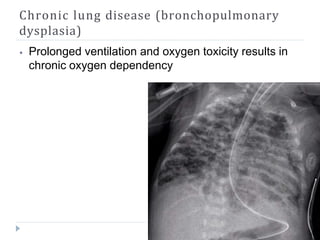 Chronic lung disease (bronchopulmonary
dysplasia)
⦁ Prolonged ventilation and oxygen toxicity results in
chronic oxygen dependency
 