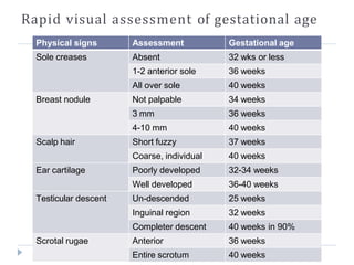 Physical signs Assessment Gestational age
Sole creases Absent 32 wks or less
1-2 anterior sole 36 weeks
All over sole 40 weeks
Breast nodule Not palpable 34 weeks
3 mm 36 weeks
4-10 mm 40 weeks
Scalp hair Short fuzzy 37 weeks
Coarse, individual 40 weeks
Ear cartilage Poorly developed 32-34 weeks
Well developed 36-40 weeks
Testicular descent Un-descended 25 weeks
Inguinal region 32 weeks
Completer descent 40 weeks in 90%
Scrotal rugae Anterior 36 weeks
Entire scrotum 40 weeks
Rapid visual assessment of gestational age
 