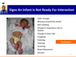 Color changes Blueness around the mouth Skin mottling Change in respiratory rate or rhythm Change in heart rate Coughing Sneezing Yawning Vomiting Bowel Movement Hiccups Physiological Signs An Infant Is Not Ready For Interaction 