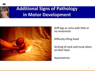 Additional Signs of Pathology  in Motor Development  Stiff legs or arms with little or no movement Difficulty lifting head Arching of neck and trunk when on their back Asymmetries  