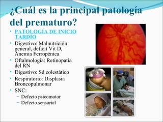 ¿Cuál es la principal patología
del prematuro?
• PATOLOGÍA DE INICIO
    TARDÍO
•   Digestivo: Malnutrición
    general, deficit Vit D,
    Anemia Ferropénica
•   Oftalmología: Retinopatía
    del RN
•   Digestivo: Sd colestático
•   Respiratorio: Displasia
    Broncopulmonar
•   SNC:
    – Defecto psicomotor
    – Defecto sensorial
 