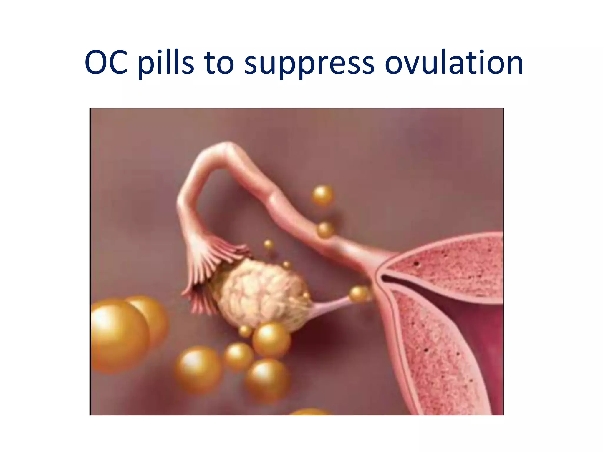 Progesterone alone 	Used for many years	No supporting evidence	Progesterone has not been demonstrated to work better than placebo for treatment of mood symptoms of PMS.-Ford O, Lethaby A, Mol B, Roberts H. Progesterone for premenstrual syndrome. 	Cochrane Database Syst Rev. 2006;(4):CD003415.	-Wyatt K, Dimmock P, Jones P, Obhrai M, O'Brien E. Efficacy of progesterone and progestins in management of premenstrual symptoms: a systematic review.	BMJ. 2001;323:776-780