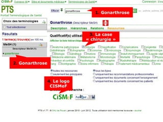 1. Gonarthrose




                               3. La case
                              « chirurgie »




2. Gonarthrose



                 4. Le logo
                  CISMeF
 