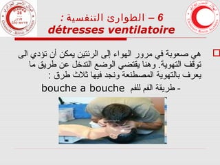 ‫6 – الطوارئ التنفسية :‬
‫‪détresses ventilatoire‬‬

‫‪‬‬

‫هي صعوبة في مرور الهواء إلى الرئتين يمكن أن تؤدي الى‬
‫توقف التهوية. وهنا يقتضي الوضع التدخل عن طريق ما‬
‫يعرف بالتهوية المصطنعة ونجد فيها ثل ث طرق :‬
‫- طريقة الفم للفم ‪bouche a bouche‬‬

 