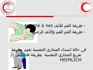 ‫ طريقة الفم للنف ‪bouche à nez‬‬‫- طريقة الفم للفم والنف للرضيع‬

‫في حالة انسداد المجاري التنفسية نقوم بطريقة‬
‫تفريغ المجاري التنفسية بطريقة هايمليش‬
‫‪HEIMLICH‬‬

 