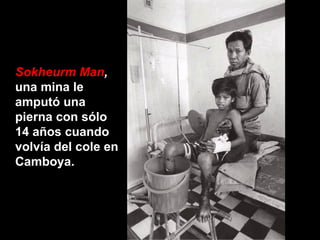 Sokheurm Man ,  una mina le amputó una pierna con sólo 14 años cuando volvía del cole en Camboya.   
