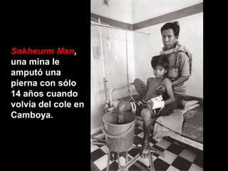 Sokheurm Man,
una mina le
amputó una
pierna con sólo
14 años cuando
volvía del cole en
Camboya.
 