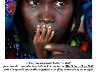 O fotógrafo canadense Finbarr O'Reilly foi aclamado o vencedor do prêmio de Foto do Ano do  'World Press Photo 2005' , com a imagem de uma mulher nigeriana e seu filho, padecendo de desnutrição. 