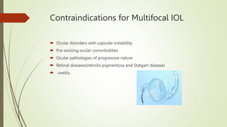 Contraindications for Multifocal IOL
 Ocular disorders with capsular instability
 Pre-existing ocular comorbidities
 Oc...