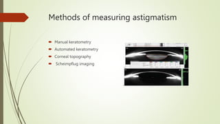 Methods of measuring astigmatism
 Manual keratometry
 Automated keratometry
 Corneal topography
 Scheimpflug imaging
 