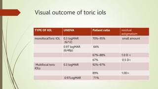 Visual outcome of toric iols
TYPE OF IOL UNDVA Patient ratio residual
astigmatism
monofocalToric IOL 0.3 logMAR
(6/12)
70%...