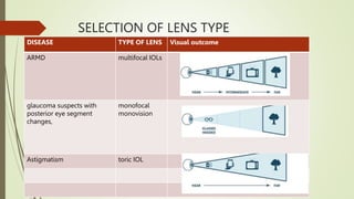 SELECTION OF LENS TYPE
DISEASE TYPE OF LENS Visual outcome
ARMD multifocal IOLs
glaucoma suspects with
posterior eye segme...