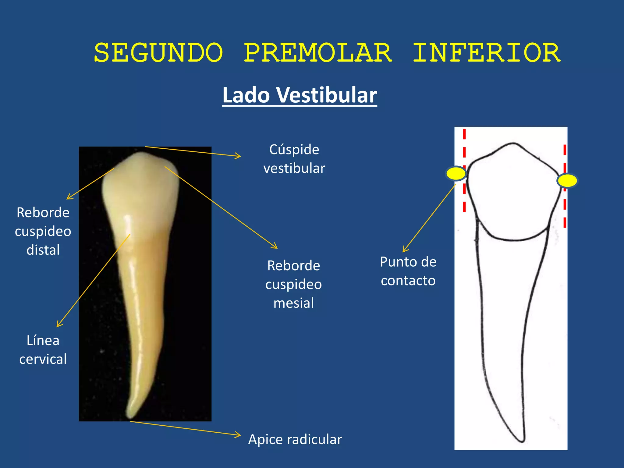 Anatomia Premolares inferiores PPT