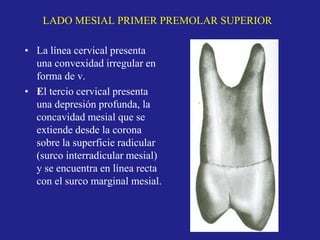 LADO MESIAL PRIMER PREMOLAR SUPERIOR
• La línea cervical presenta
una convexidad irregular en
forma de v.
• El tercio cervical presenta
una depresión profunda, la
concavidad mesial que se
extiende desde la corona
sobre la superficie radicular
(surco interradicular mesial)
y se encuentra en línea recta
con el surco marginal mesial.
 