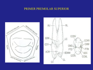 PRIMER PREMOLAR SUPERIOR
 