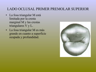 LADO OCLUSAL PRIMER PREMOLAR SUPERIOR La fosa triangular M está limitada por la cresta marginal M y las crestas triangulares V y L. La fosa triangular M es más grande en cuanto a superficie ocupada y profundidad. 