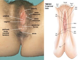 • E. Vestibule – narrow
space seen when the labia
minora are separated.
Almond shape area that
contains the hymen, vaginal...