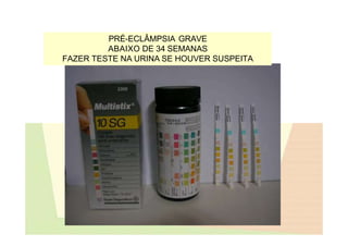 PRÉ-ECLÂMPSIA GRAVE
ABAIXO DE 34 SEMANAS
FAZER TESTE NA URINA SE HOUVER SUSPEITA
 