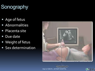 Sonography

 Age of fetus
 Abnormalities
 Placenta site
 Due date
 Weight of fetus
 Sex determination                            is illegal




                      Dept of OBGYN...SATNAM HOSPITAL
 