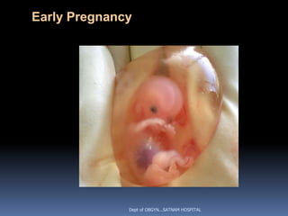 Early Pregnancy




              Dept of OBGYN...SATNAM HOSPITAL
 