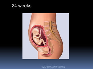 24 weeks




           Dept of OBGYN...SATNAM HOSPITAL
 
