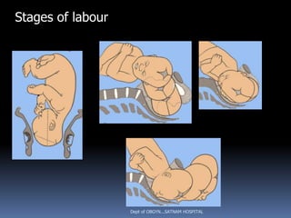 Stages of labour




                   Dept of OBGYN...SATNAM HOSPITAL
 