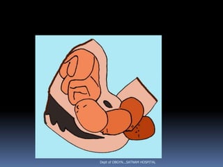 Dept of OBGYN...SATNAM HOSPITAL
 