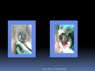 Dept of OBGYN...SATNAM HOSPITAL
 