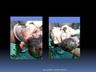 Dept of OBGYN...SATNAM HOSPITAL
 